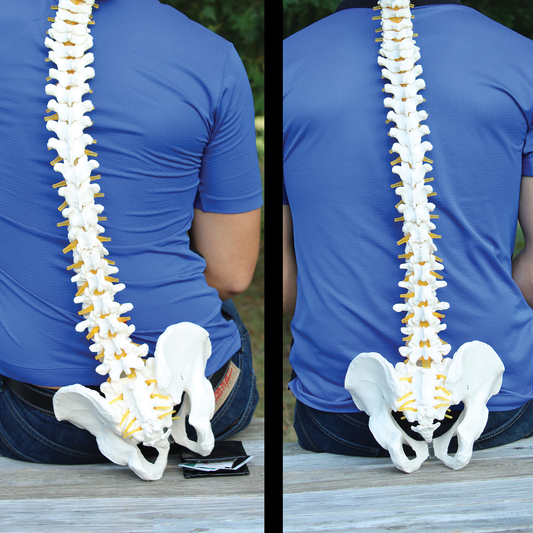 ¿Cómo tu billetera puede estar dañando tu cuerpo?